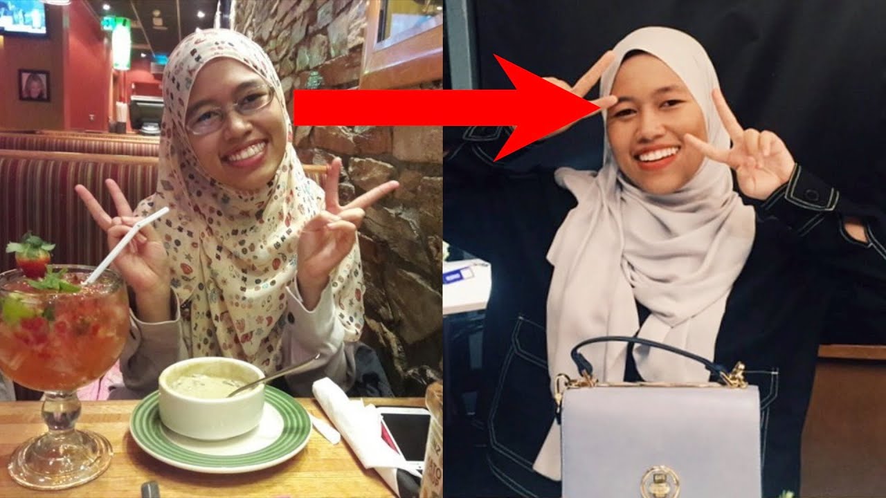 Berbaloi Tak Buat LASIK?