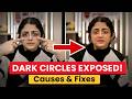 Dark Under Eyes? Causes, Pigmentation &amp; Advanced Treatments! | Clear Skin Clinic, Pune