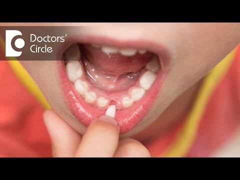 Video: When The First Teeth Fall Out