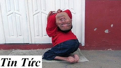 Tin Tức -Nghị lực sống phi thường của chàng trai bị ngược đầu