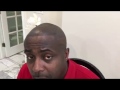 Mr. R Before & After Micropigmentation Treatment | The Hair Simulation Co.