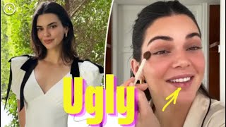 Kendall Jenner revealed her ugly appearance with dark circles under her eyes and a wound on her lip