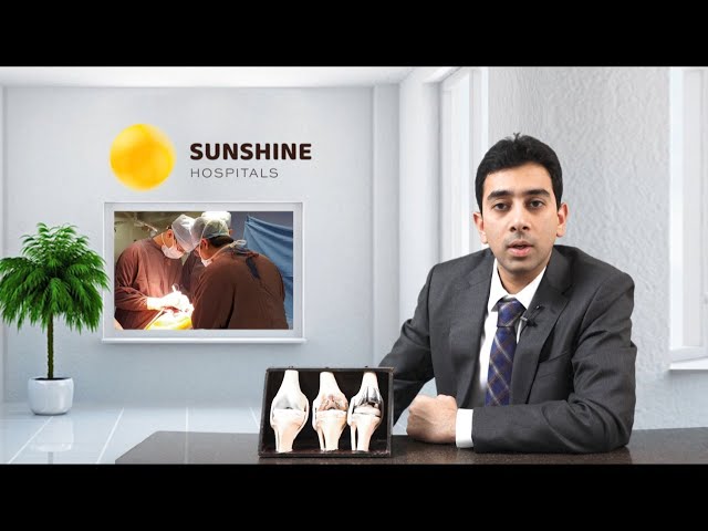 Total Knee Replacement Surgery | Dr Adarsh Annapareddy | Orthopedic Surgeon | Sunshine Hospitals