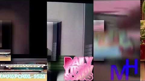 87 Shuric scans with are slides 