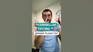 🧠Cerebellar (Coordination) Testing #shorts