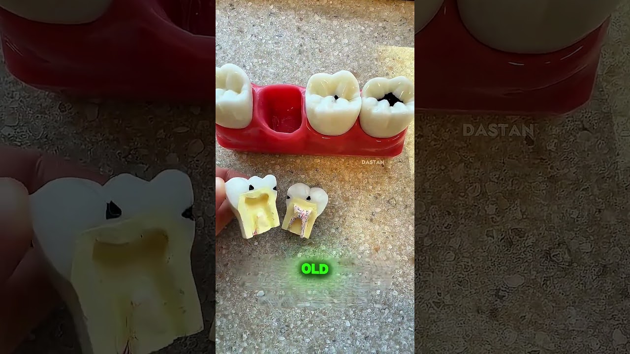 Never do ignore cavity🙂