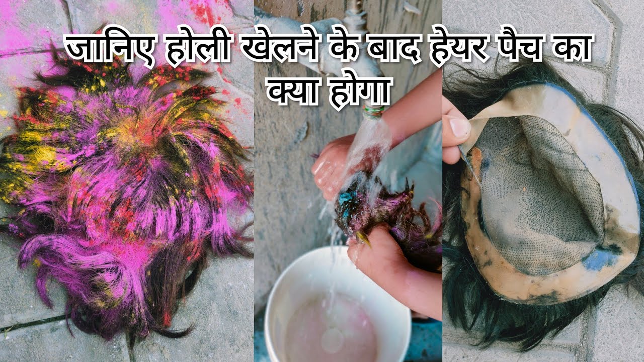 hair patch ludhiana (जानिए होली खेलने के बाद हेयर पैच का क्या होगा