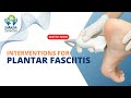 Mastering ultrasoundguided intervention for plantar fasciitis