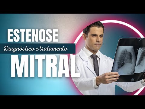 Vídeo: Estenose Mitral - Sintomas, Graus, Tratamento