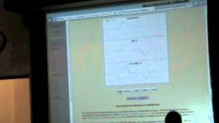 Chap21 01 Superposition of two pulses