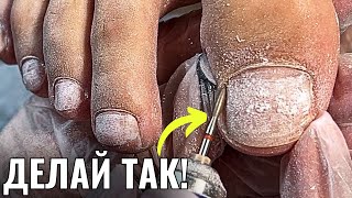 видео: ПЕДИКЮР ПОДРОБНО! картинка: ПЕДИКЮР ПОДРОБНО!