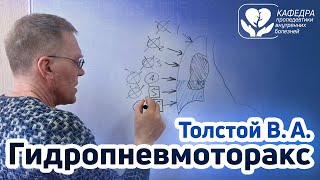 Гидропневмоторакс.