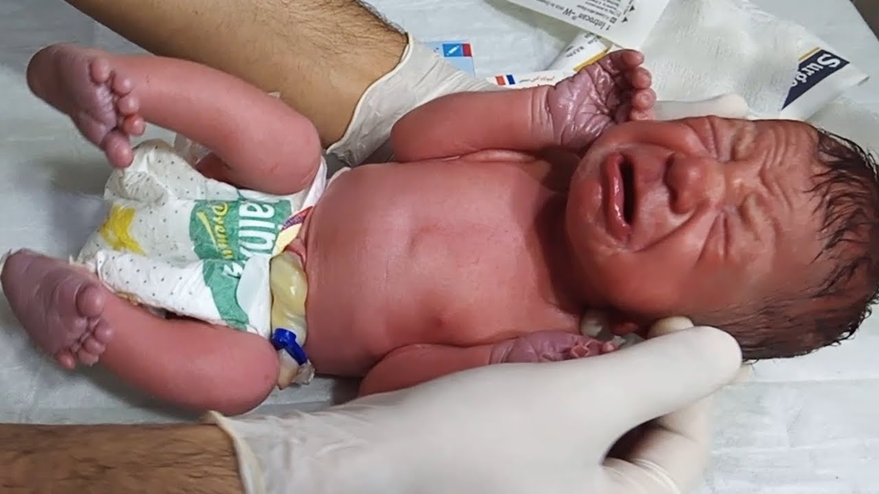 Iv Line Baby Newborn Baby IV Line Management | Medication Administration & Emergency ...