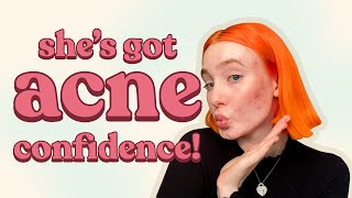 How I stopped hating my skin: 5 tips for acne confidence ✨