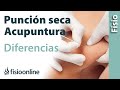 ¿La punción seca es acupuntura? Cuáles son sus diferencias