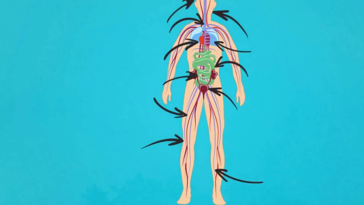 What is POTS? Dysautonomia International 2016 YouTube