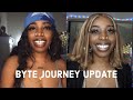 Closing My Gap At Home Update - The REAL Tea On Byte Aligners