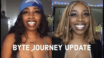 Closing My Gap At Home Update - The REAL Tea On Byte Aligners