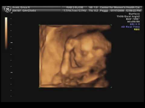 baby girl 5 months old in pregnancy - YouTube