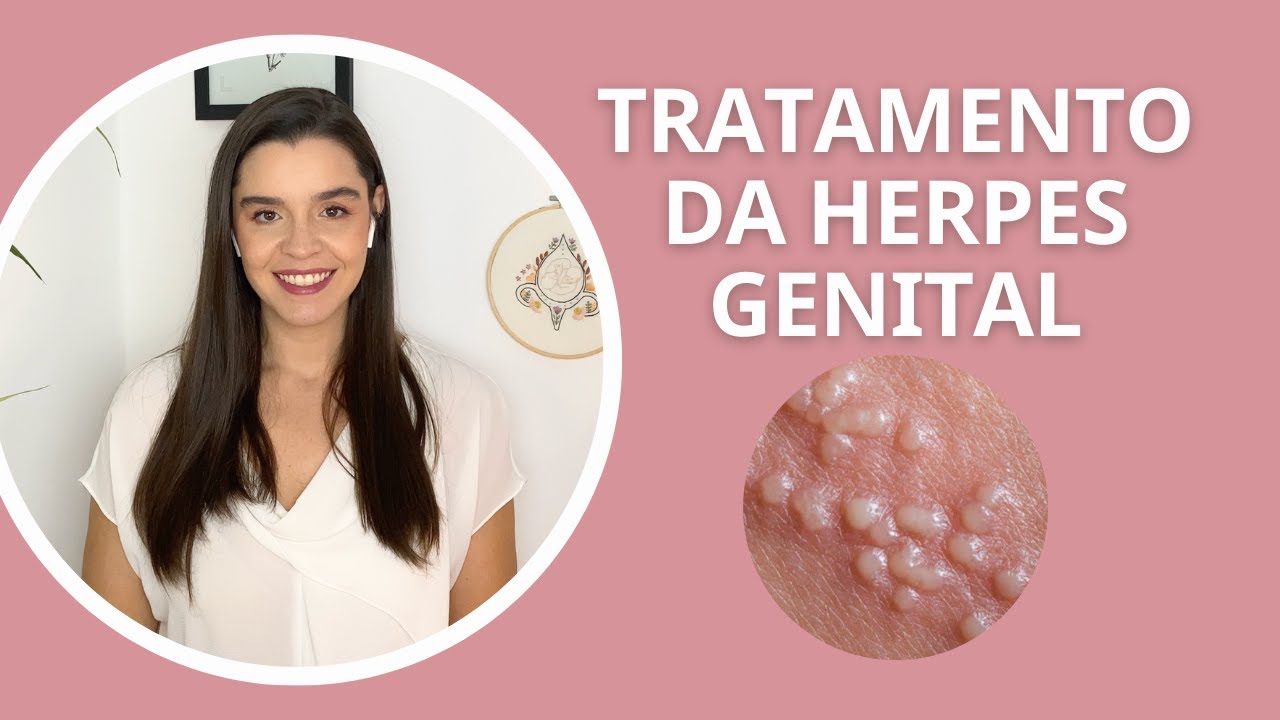 Tratamento da herpes genital, como tratar herpes genital - YouTube