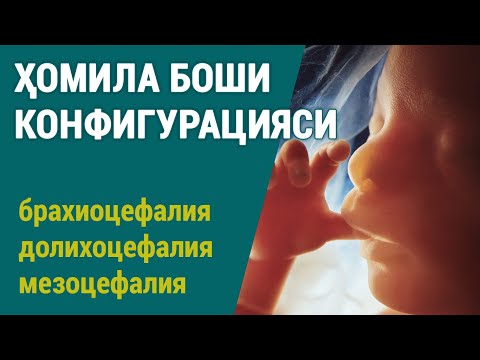 Бейне: Мезоцефалия сөзі нені білдіреді?