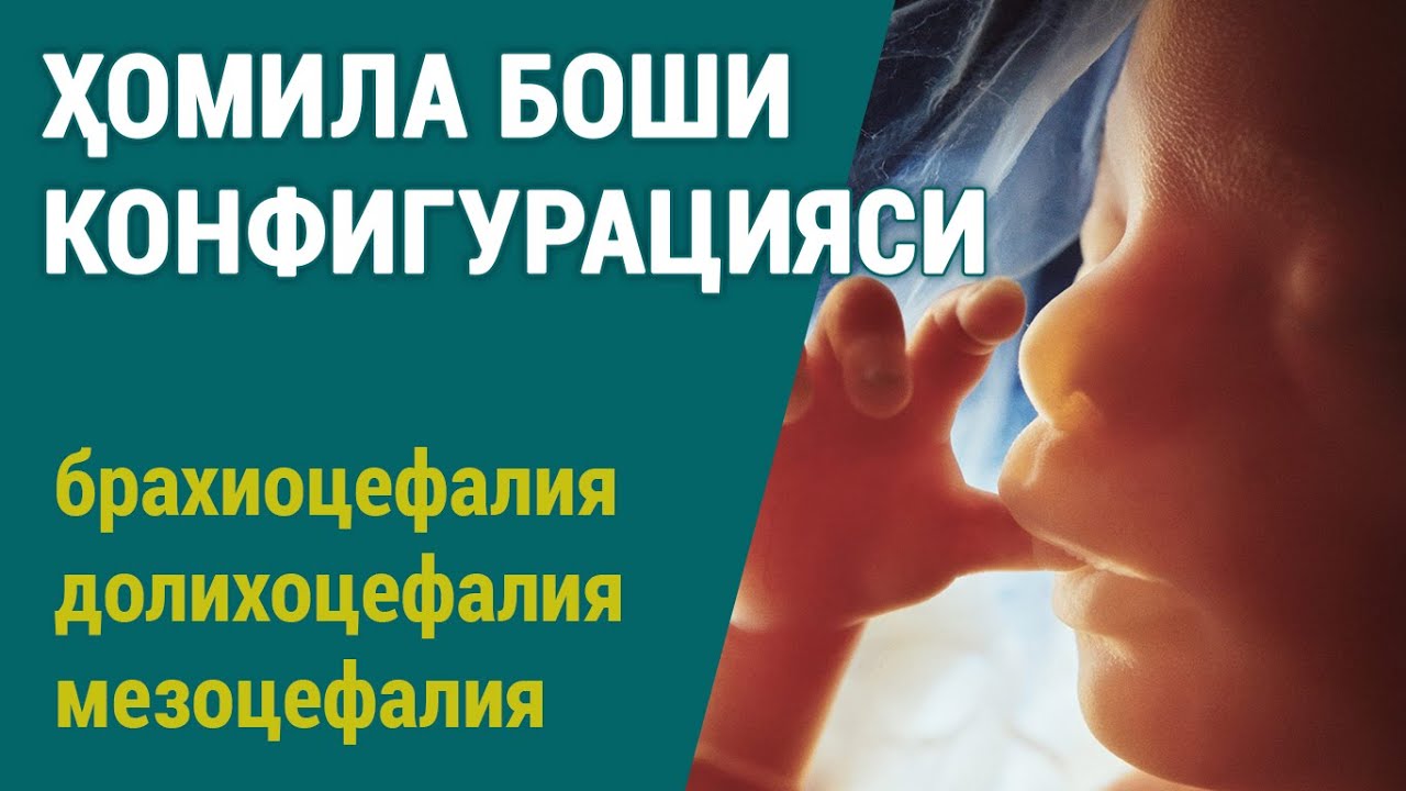 Ҳомила боши конфигурацияси: брахиоцефалия, мезоцефалия, долихоцефалия ...