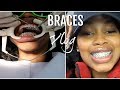 COME WITH ME TO GET BRACES! PAIN LEVEL & COPING WITH THEM THE FIRST FEW DAYS