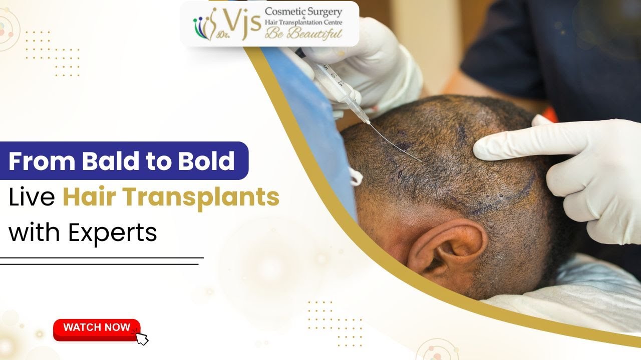 From Bald to Bold – LIVE Hair Transplant with Experts!
