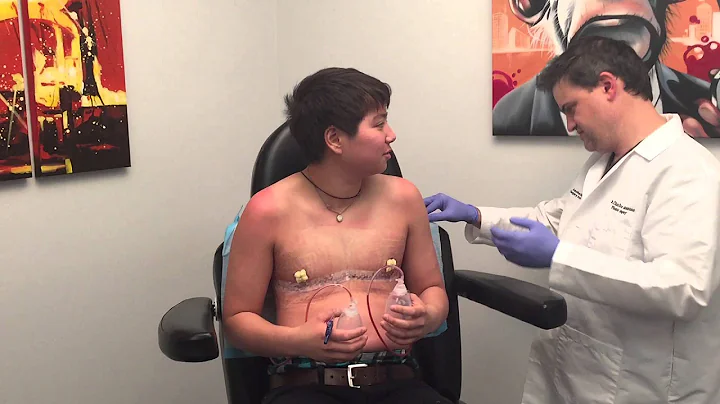 FTM Top Surgery Reveal with Dr. Garramone!