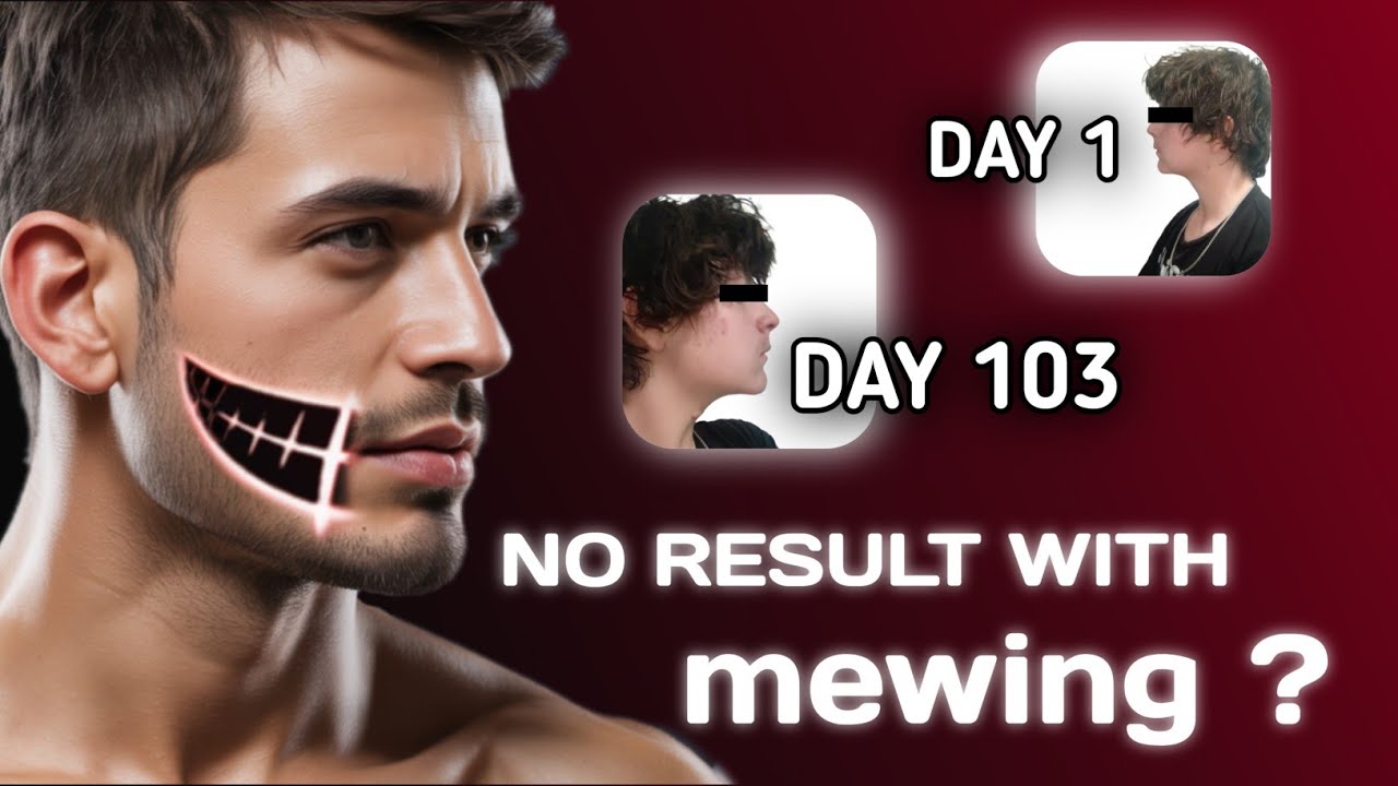 Still not seeing results from mewing? 🤔/Malayalam 