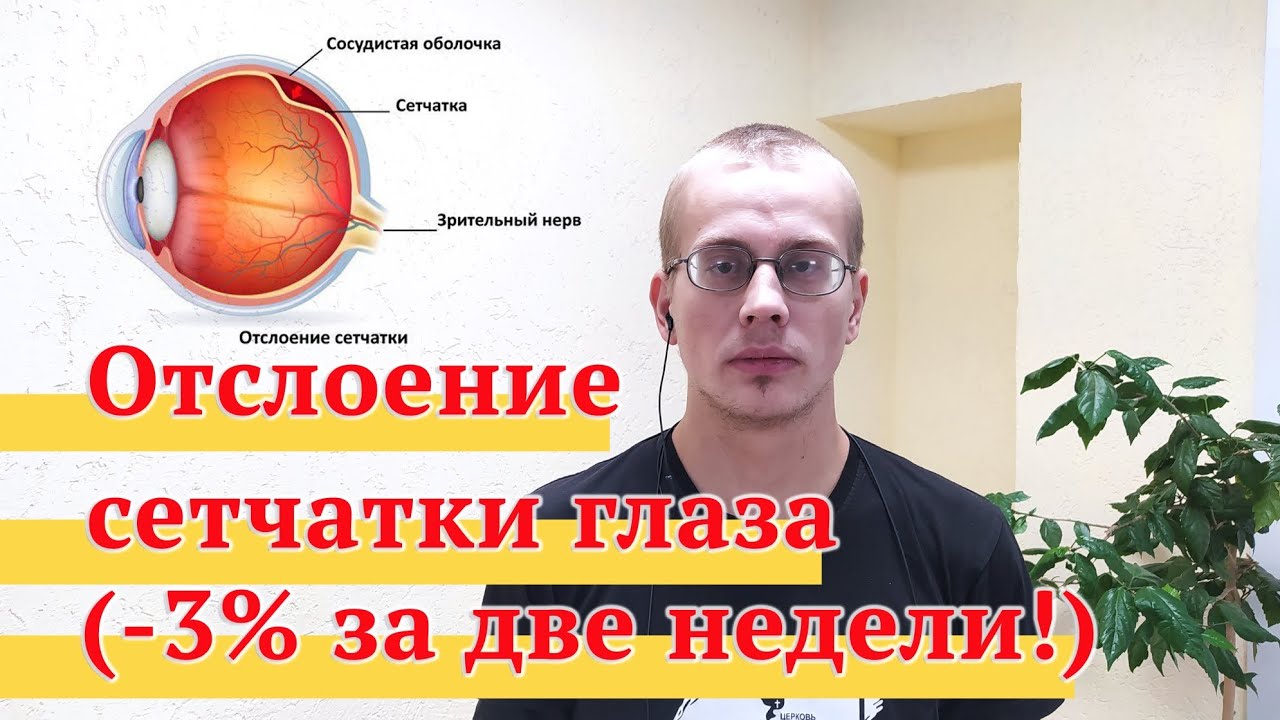 ОТСЛОЕНИЕ СЕТЧАТКИ ГЛАЗА || ПОТЕРЯ ЗРЕНИЯ || СРОЧНАЯ ПОМОЩЬ!!! | РЕПОСТ ...