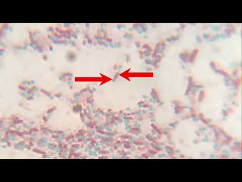 schaeffer fulton endospore stain Endospore stain the endospore stain is a differential stain used to visualize bacterial endospores endospores are formed by a few genera of bacteria, such as bacillus. schaeffer fulton endospore stain Endospore stain the endospore stain is a differential stain used to visualize bacterial endospores endospores are formed by a few genera of bacteria, such as bacillus.
