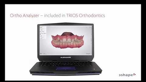 1. 3Shape Ortho Analyzer - Visão geral de demonstração