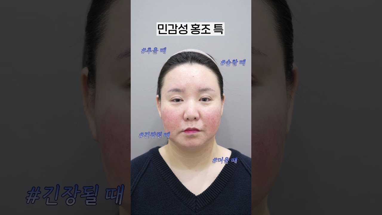 [Риэнжанг Гоо сайхны мэс заслын эмнэлэг] Үүдэл эсийн арьсны тариа #shorts