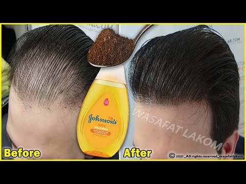 Put these ingredients in your shampoo, 🌿 it accelerates hair growth and treats baldness