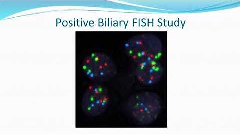 Diagnosis and Management of Biliary Strictures