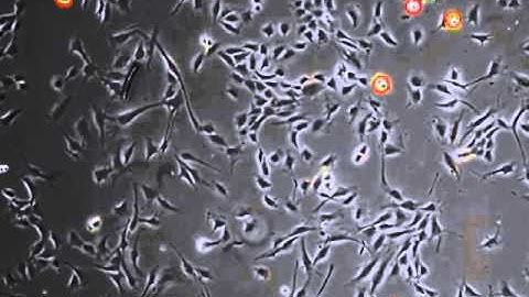 Automated mitosis detection in phase contrast microscopy