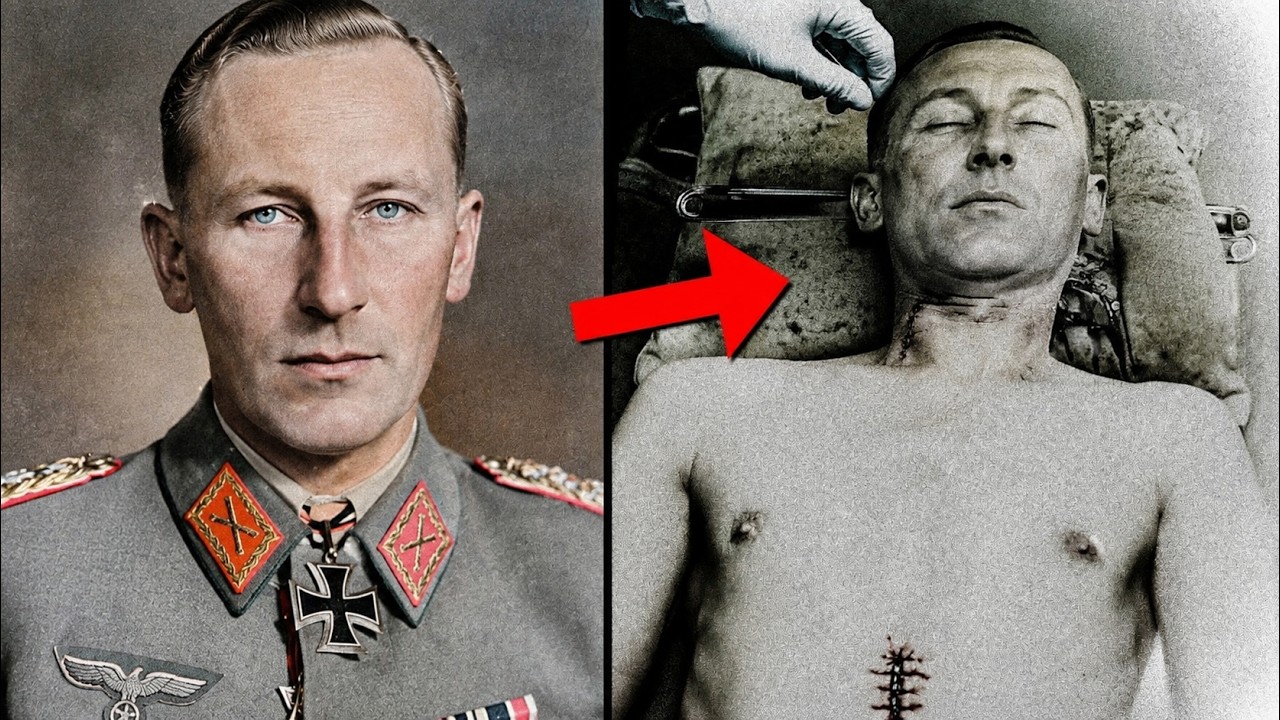 Reinhard Heydrich — His De*th, Medical Treatment and Historical Record