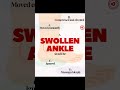 🦶 How should a swollen ankle be managed? #swollenankles #swelling #edema #anklesupport