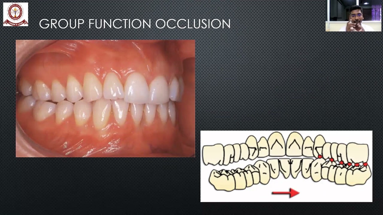 Окклюзия при использовании полных зубных протезов