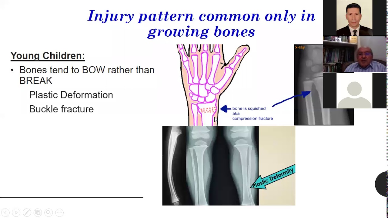 Prof  Osama Hegazy ped fracture part 1