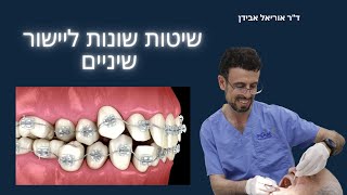 אוריאל אבידן - שיטות שונות ליישור שיניים