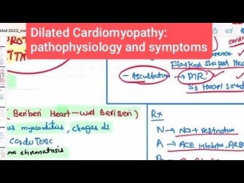 Dilated Cardiomyopathy #cardiology 101 | First Aid USMLE Step 1 in Urdu