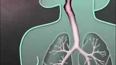 Nano Pollution and Health
