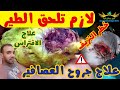 علاج نزيف جرح عصافير او حمام فى الارجل او الجناح او جسم الطير 