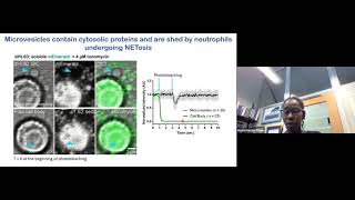 Hawa Racine Thiam: Bursting the Cell and the Nucleus to Mediate Immune Responses