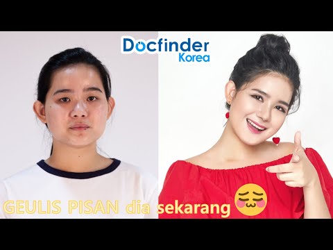 Kisah vlogger Filipina yang OPLAS di Korea 2 / 2