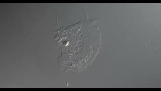 Naked amoeba 3x speed. 400x