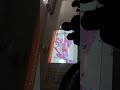 TRASTORNOS HEMODINÁMICOS PARTE2