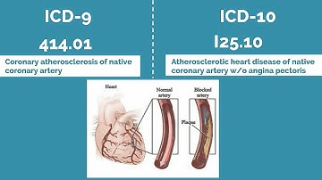 Top 20 Cardiology ICD-9 to ICD-10 Codes